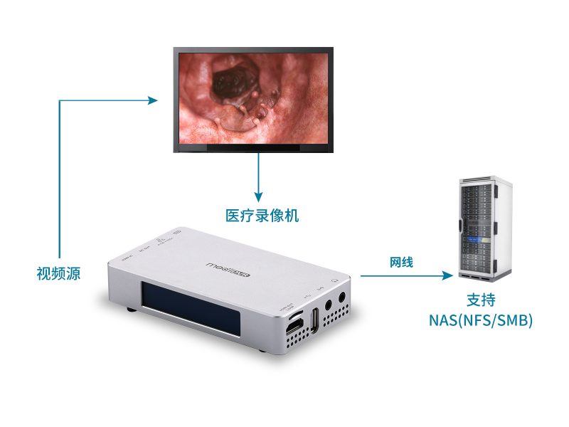 超高清4K醫(yī)療錄像機(jī)，輕便型 - 圖片 4
